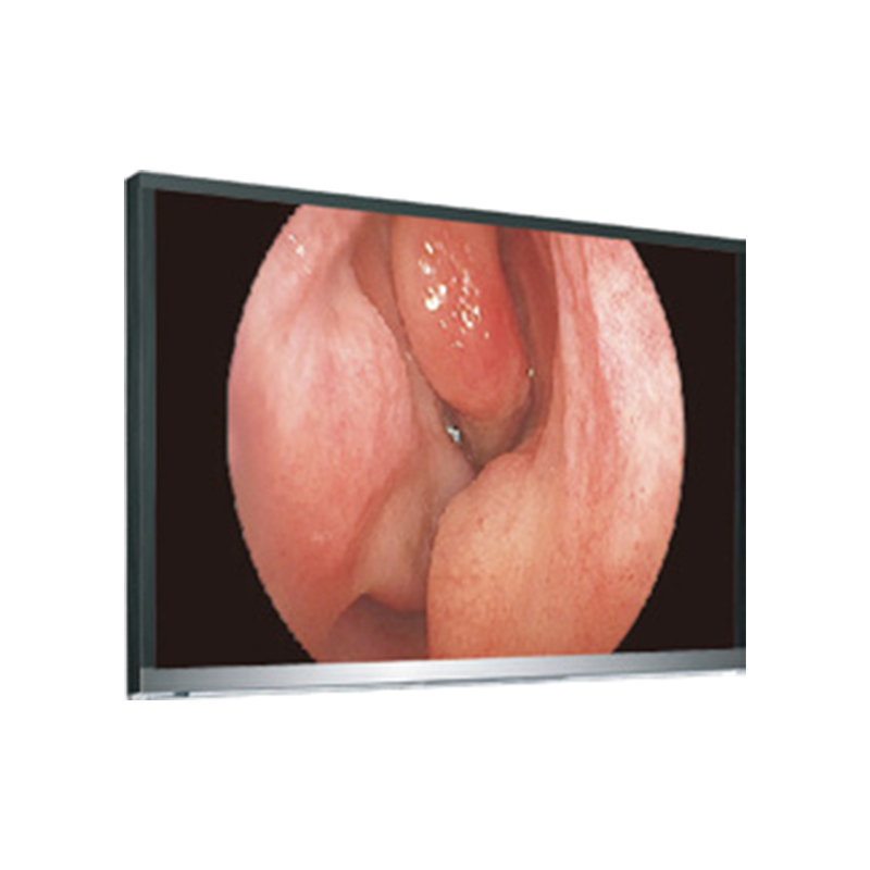 Monitor LCD 4K UHD