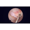 Artroscopio da 2,7 mm